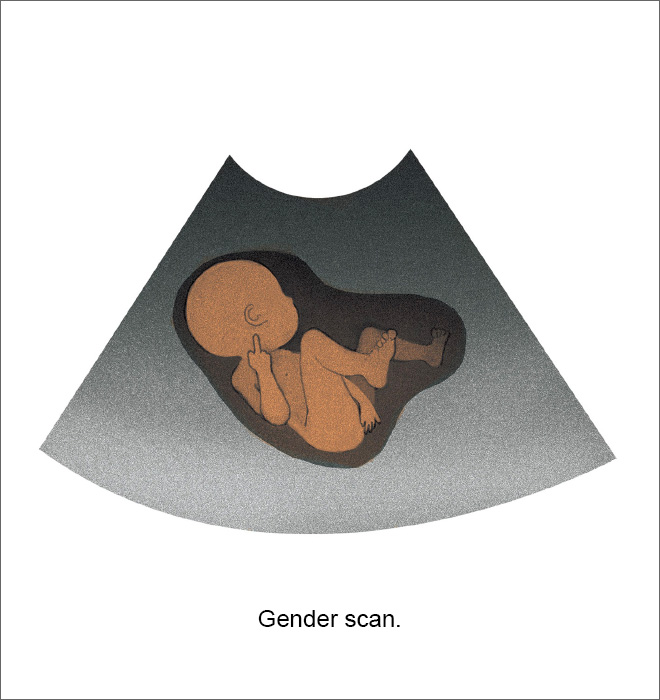Gender scan.