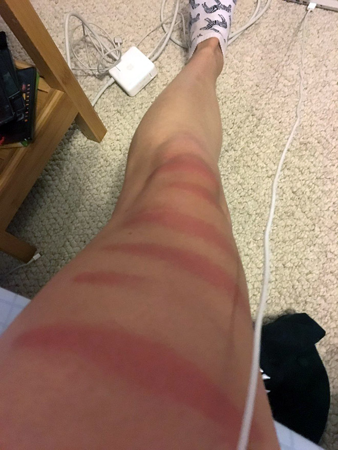 Don't wear ripped jeans in the sun.