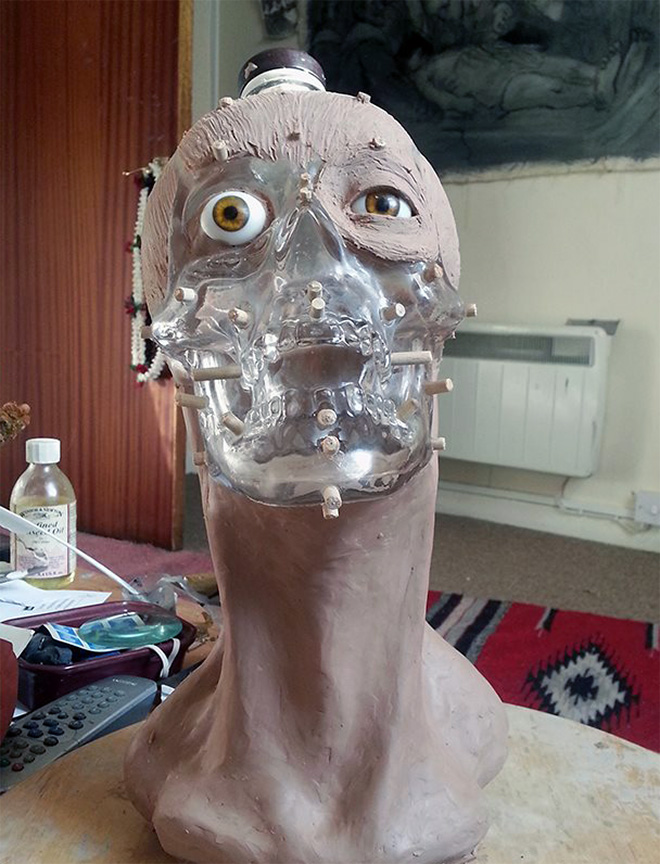 Vodka skull bottle facial reconstruction.