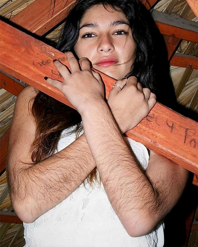 Woman with extremely hairy arms.