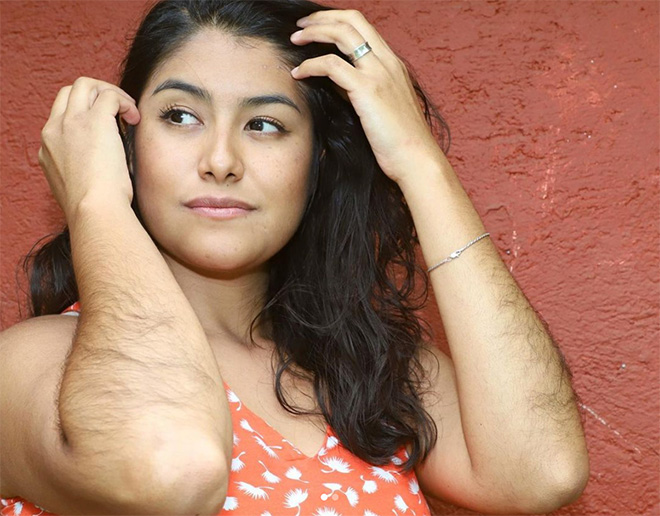 Woman with very hairy arms.