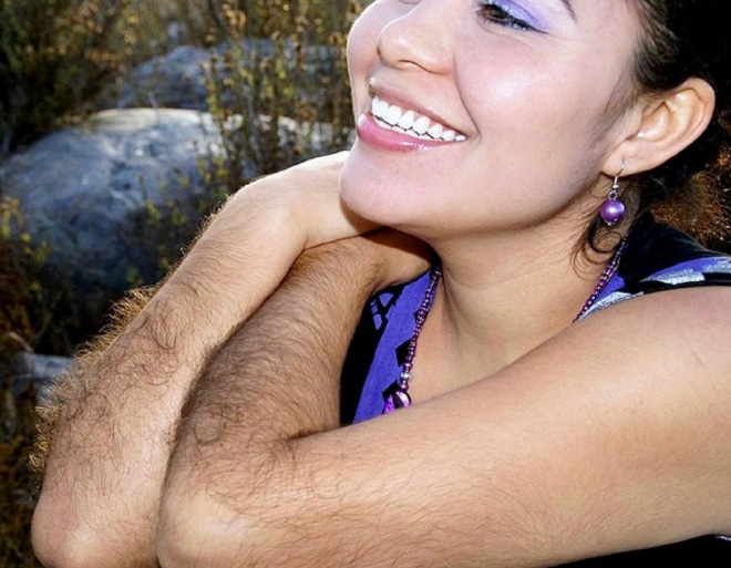Some women have very hairy arms.