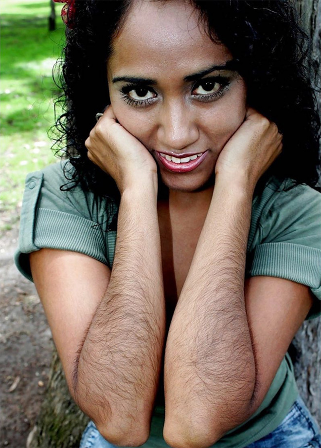 Girl with hairy arms.
