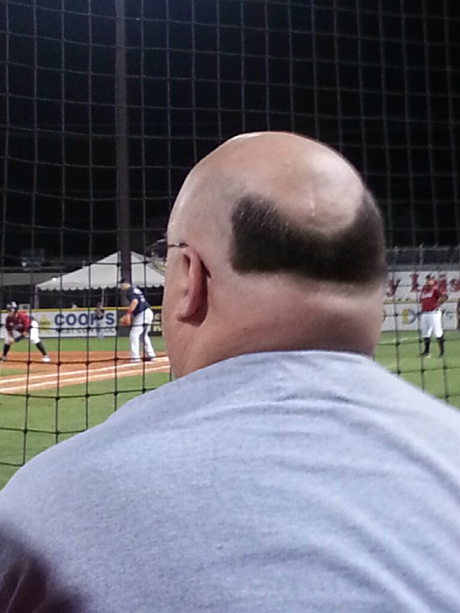 Horrible haircut fail.