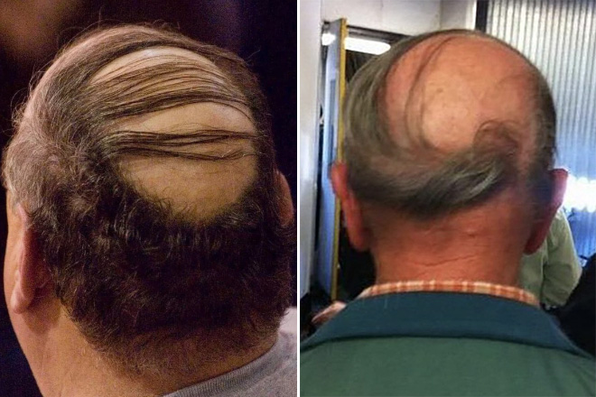Comb over is worse than a mullet.