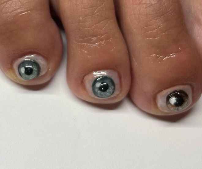 Toenail eyeballs.