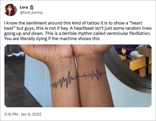 I know the sentiment around this kind of tattoo it is to show a “heart beat” but guys, this is not it hey. A heartbeat isn’t just some random lines going up and down. This is a terrible rhythm called ventricular fibrillation. You are literally dying if the machine shows this