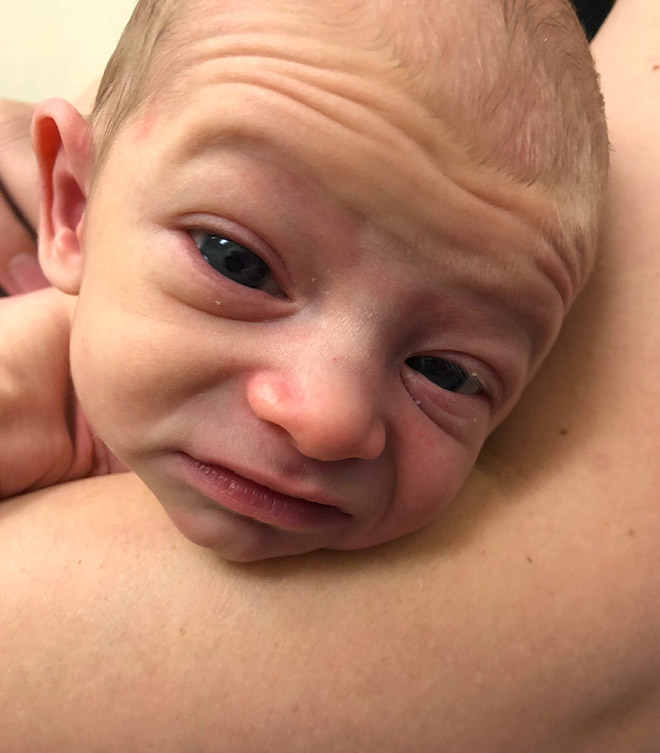 Ugly babies is a harsh reality.