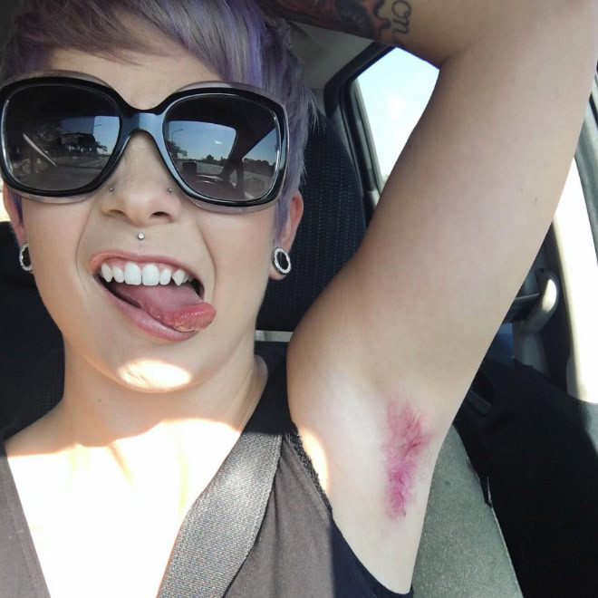 Dyed armpits.