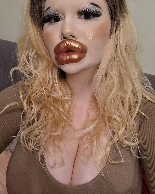 Overdone lip fillers.