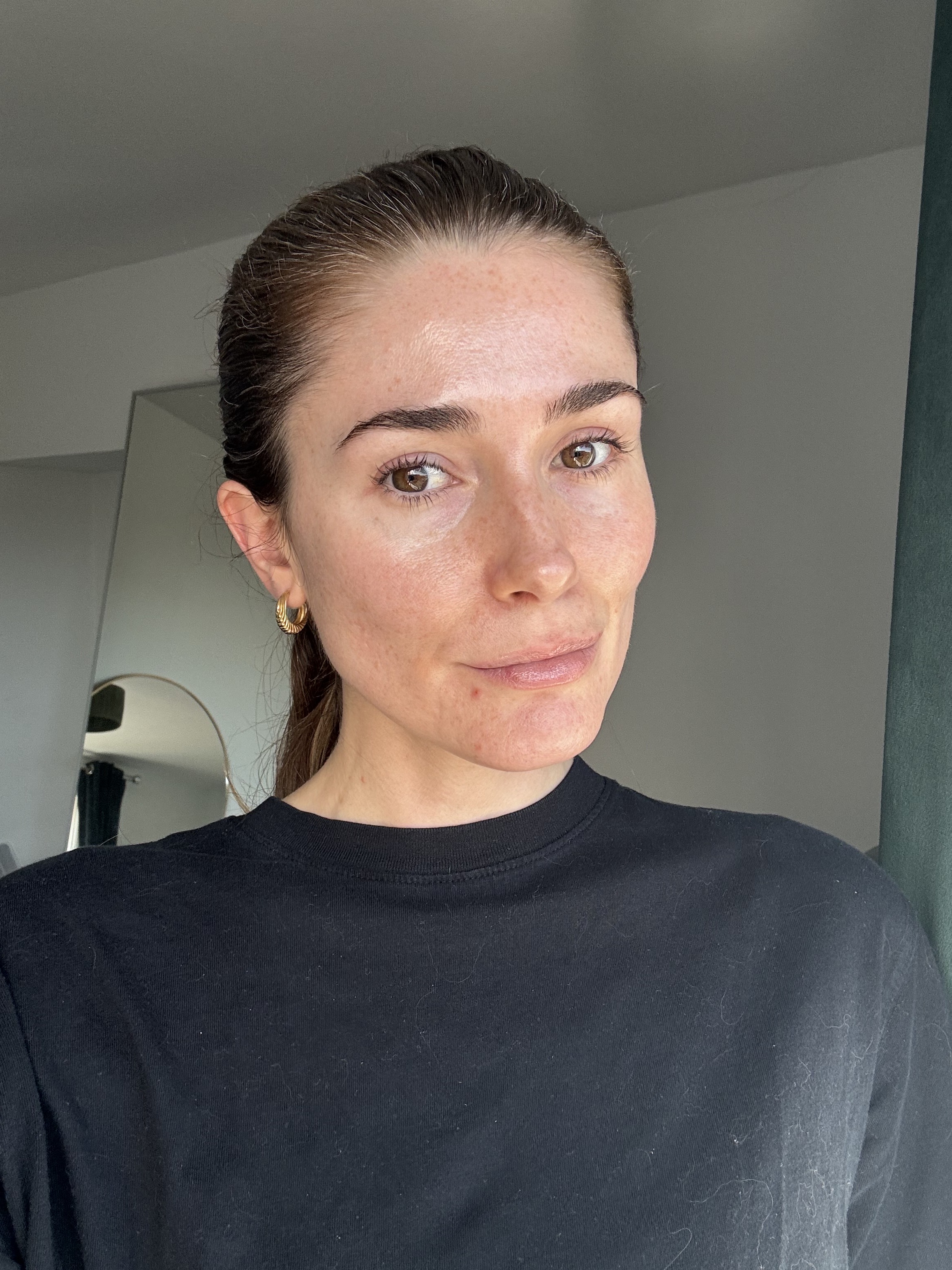 Eleanor after using the Dermalux MD LED for five weeks