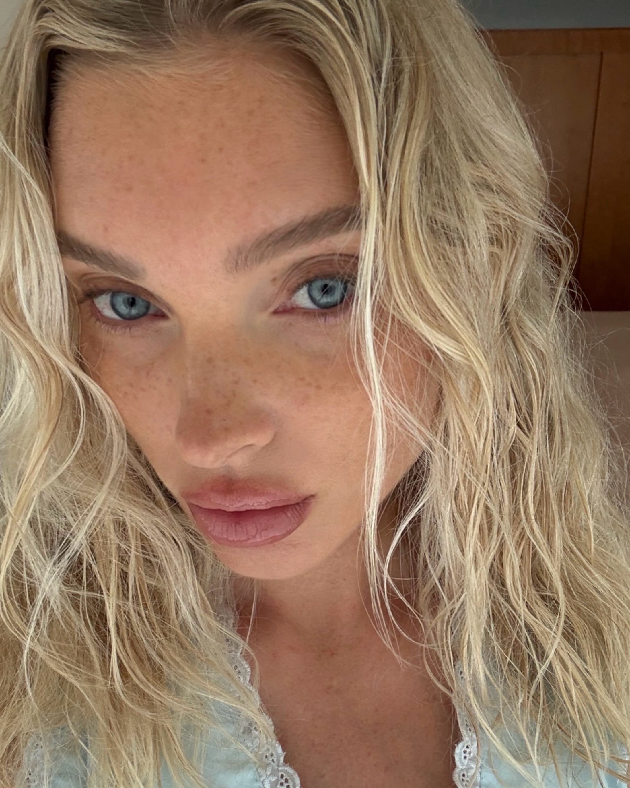Elsa Hosk freckles best products for hyperpigmentation